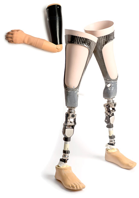 prosthetics