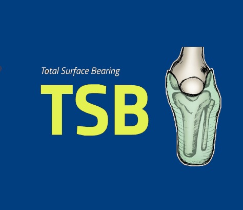 TSB